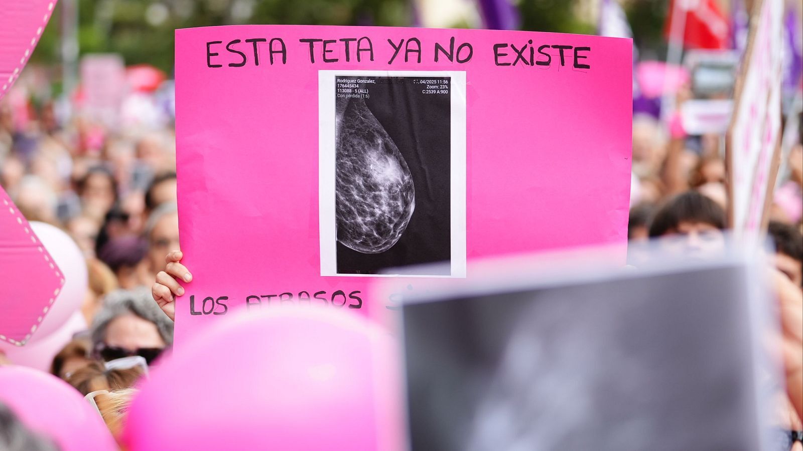 amama eleva a 3 las fallecidas por las negligencias de la junta en cáncer de mama. Foto 2.